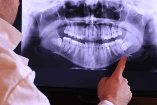 Best Cracked Tooth Emergency Dentist  in Adairsville, GA