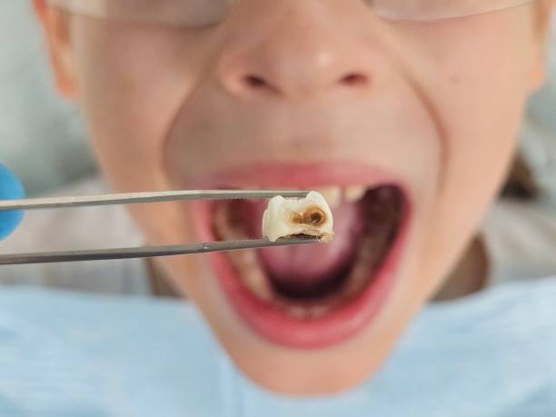 Best Broken Tooth Emergency  in Adairsville, GA