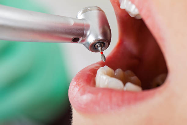 Best Tooth Pain Emergency Relief  in Adairsville, GA
